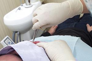 尾道で歯周病治療が評判のクリニック