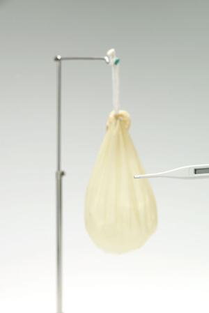 宝塚市にあるワキガ手術を多数行う病院